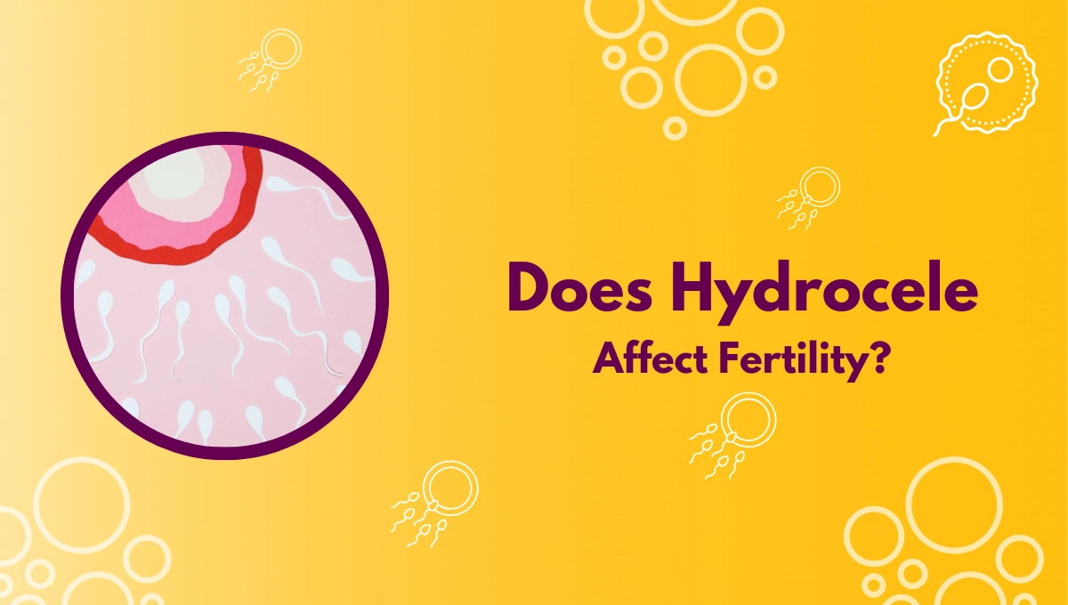 Can Hydrocele Cause Infertility?