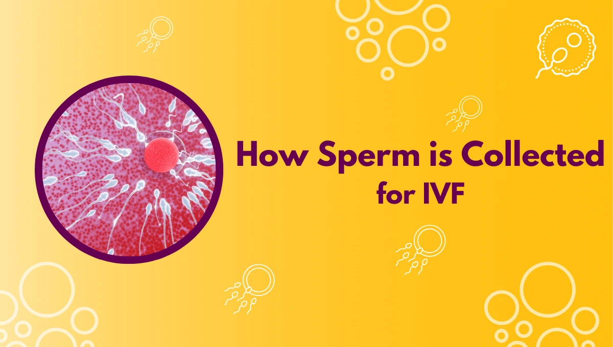 How Sperm is Collected for IVF