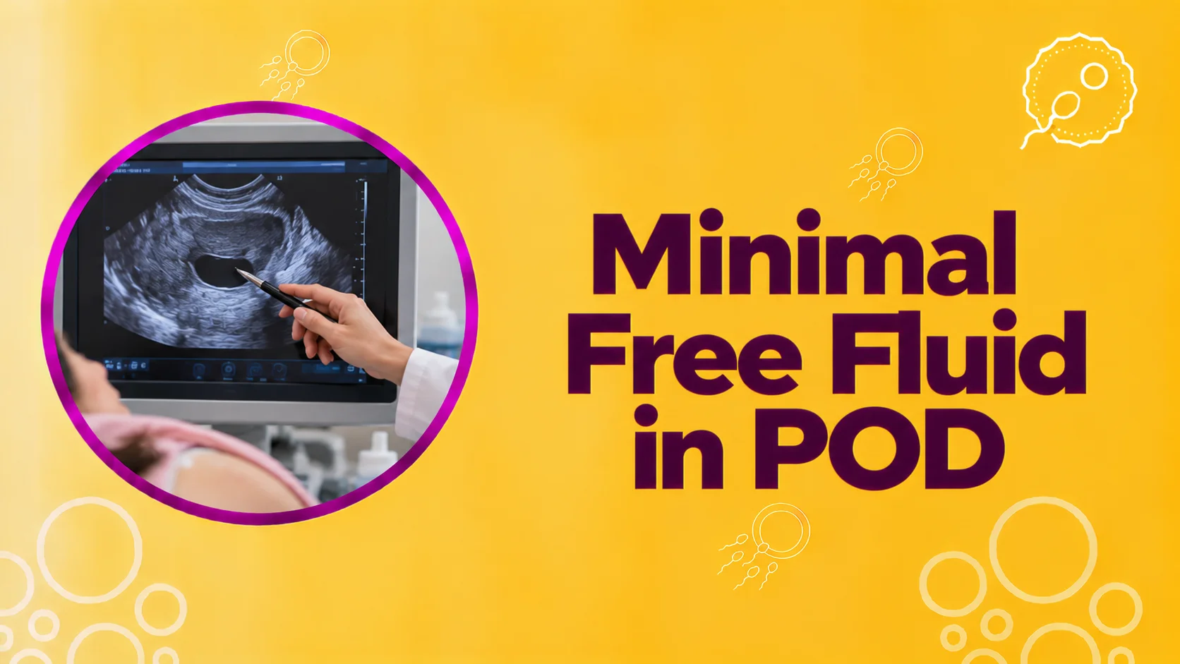 Minimal Free Fluid in POD